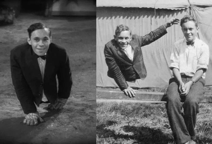 Johnny Eck