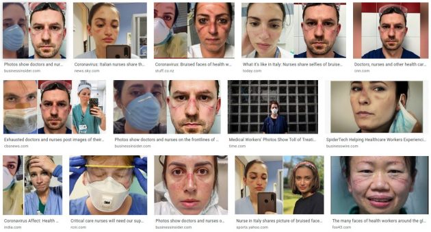 Google beelden verpleging met gehavende huid na dragen van gezichtsmaskers